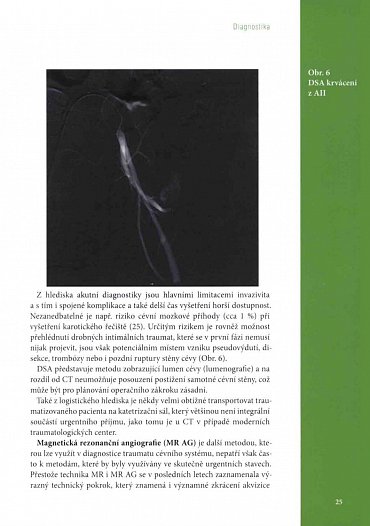 Náhled Poranění cévního systému