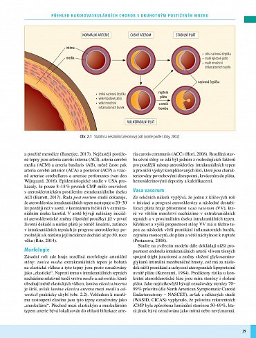 Náhled Neurokardiologie