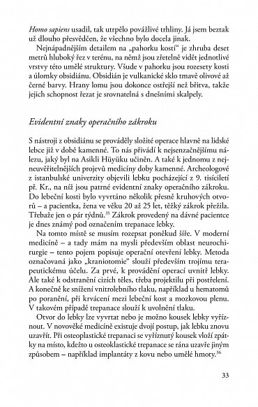 Náhled Medicína doby kamenné