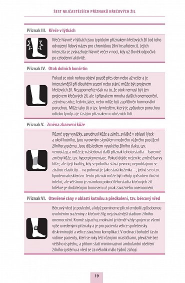 Náhled Žíly, žilky a varixy